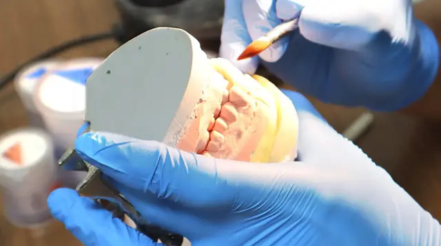 Dental model being prepared at Arirang Dental Clinic, Kuningan Jakarta